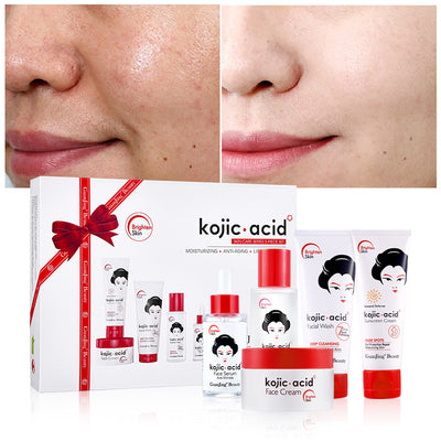 Kojic Acid Toner and Lotion
